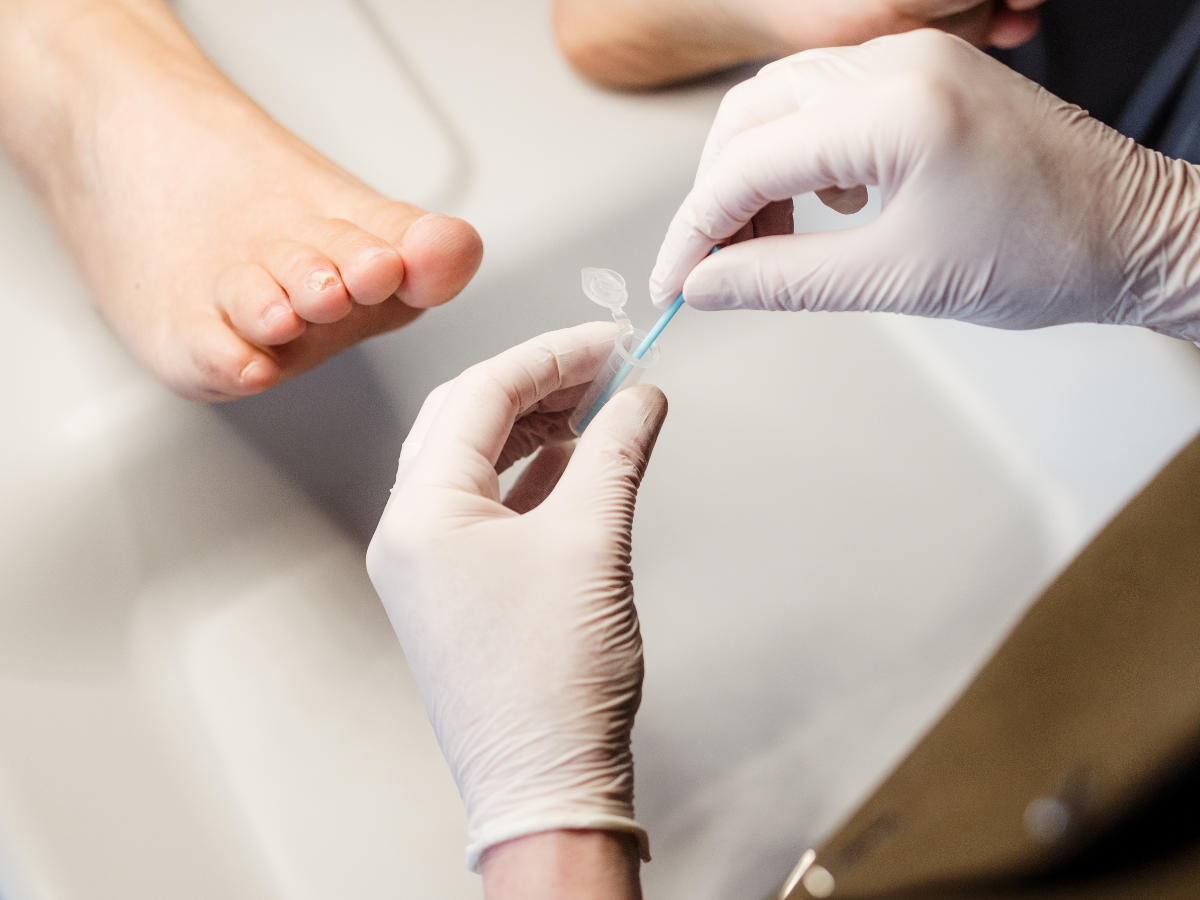 voetenspecialist-miranda-fungicheck